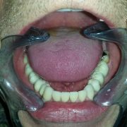 20151204_102640-1920w