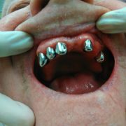 IMG_20170307_154817-1920w