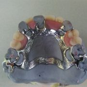 IMG_20171004_171110-b98cb612-1920w